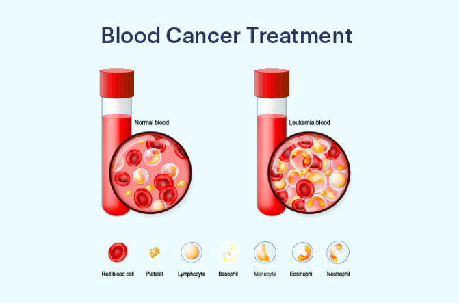 blood cancer treatment raipur | dr adamya gupta