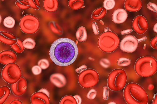 iron deficiency anemia treatment | best hemato-oncologist raipur cg dr adamya gupta cover image of blog