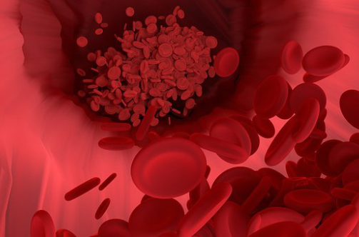 polycythemia vera treatment raipur | dr adamya gupta | hematologist raipur blog cover pic